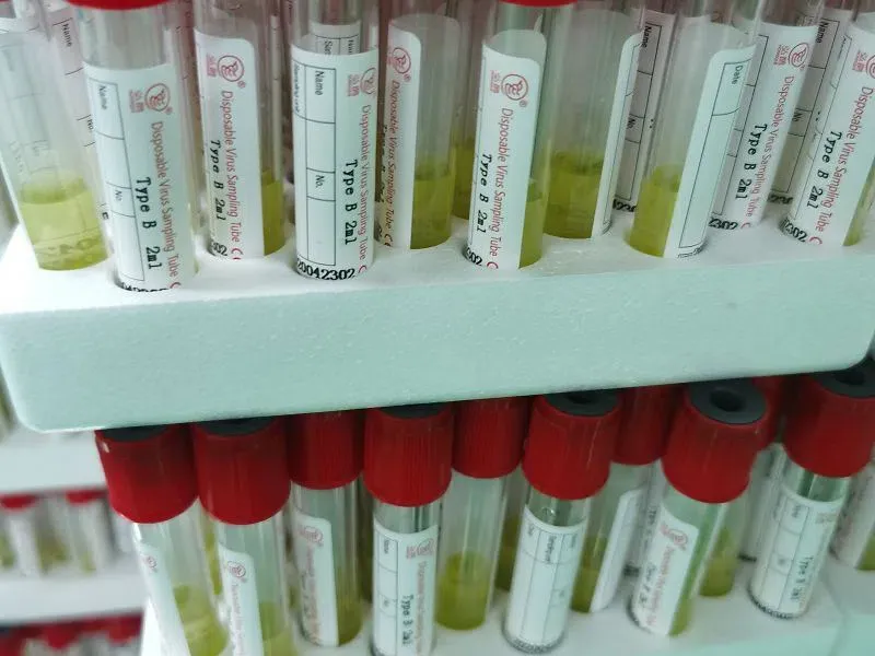 什么是病毒取样管？